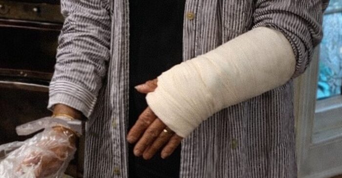 My Husband Made Me Host His Birthday Party with My Arm Broken – So I Taught Him a Lesson He’ll Never Forget